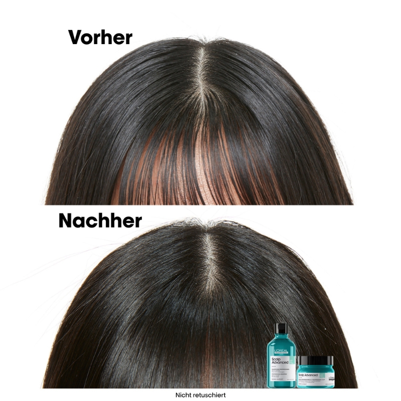 Scalp Advanced Anti-Oiliness 2in1 Deep Purifier Clay - 250ml