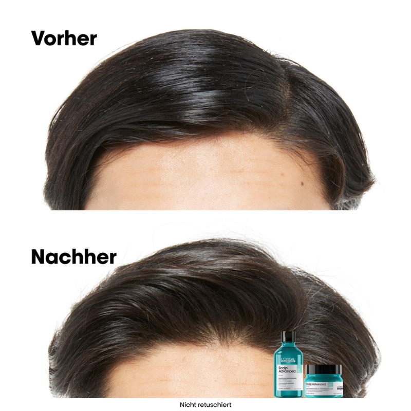 Scalp Advanced Anti-Oiliness 2in1 Deep Purifier Clay - 250ml