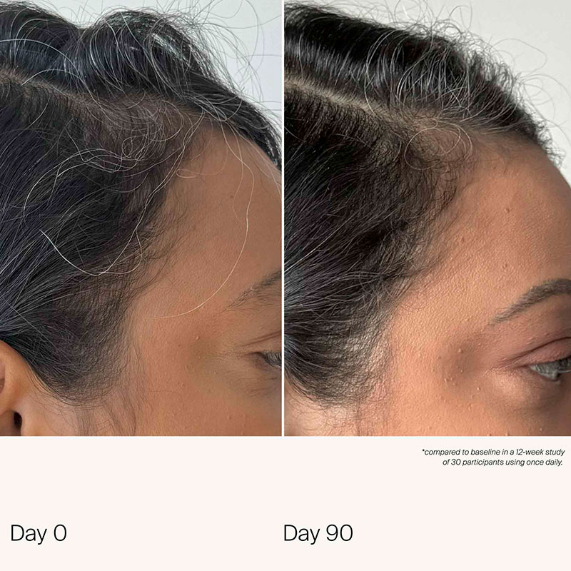 Scalp Care Density Serum - 50ml