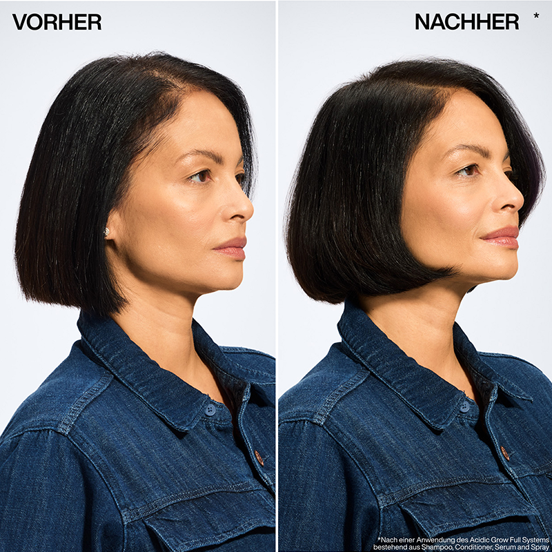 Acidic-Grow-Full-Vorher-Nachher