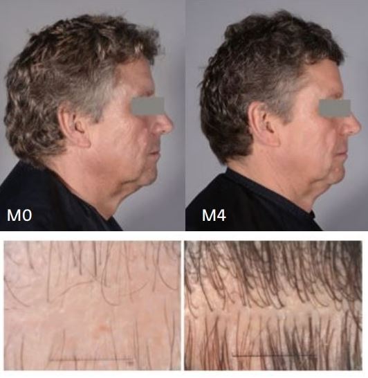 Anti-Grey-Elixir-before-After