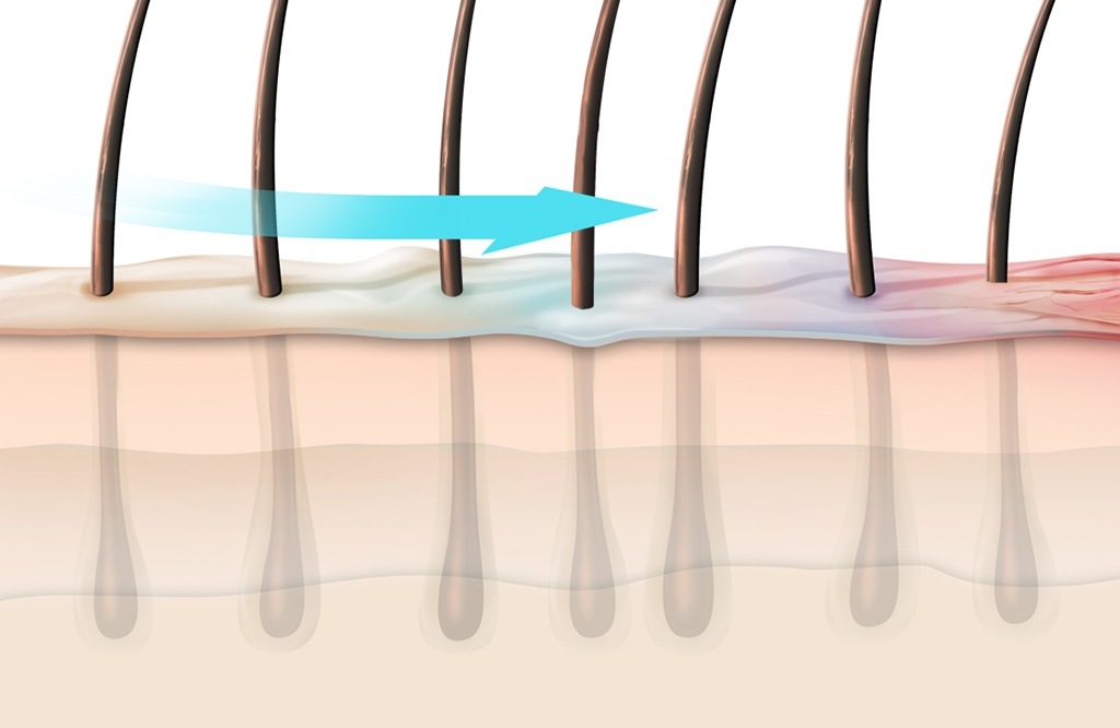 Scalp Specialist Wirkung