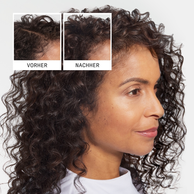 Anti-Hair Loss Shampoo - 240ml