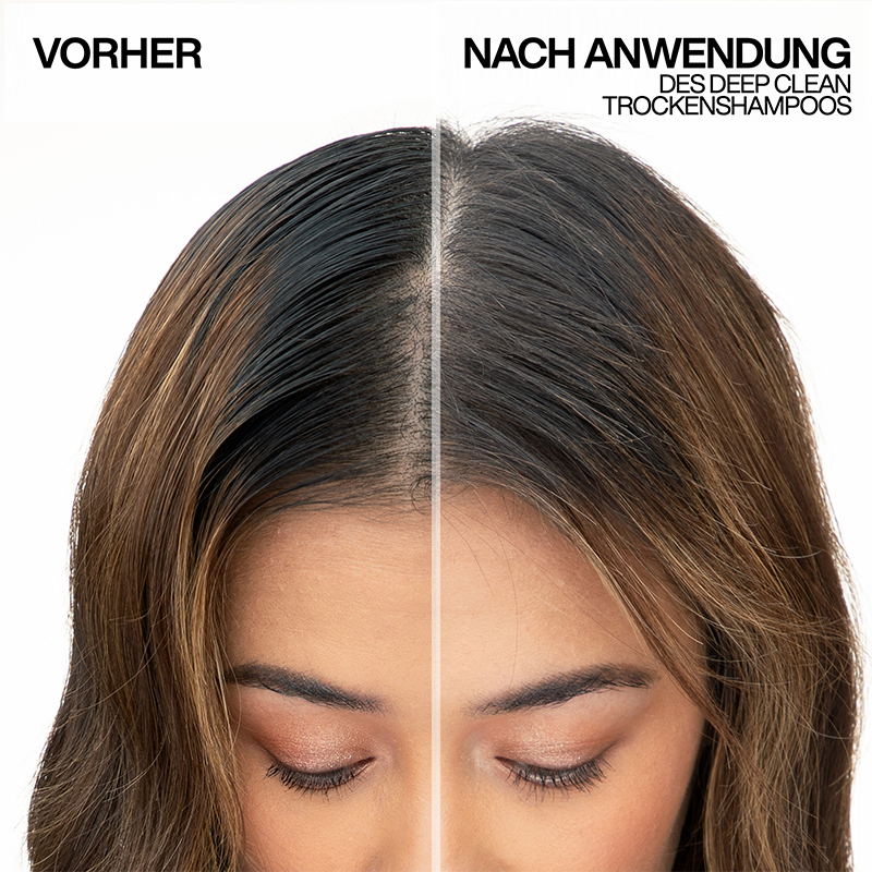 Vorher / Nachher
