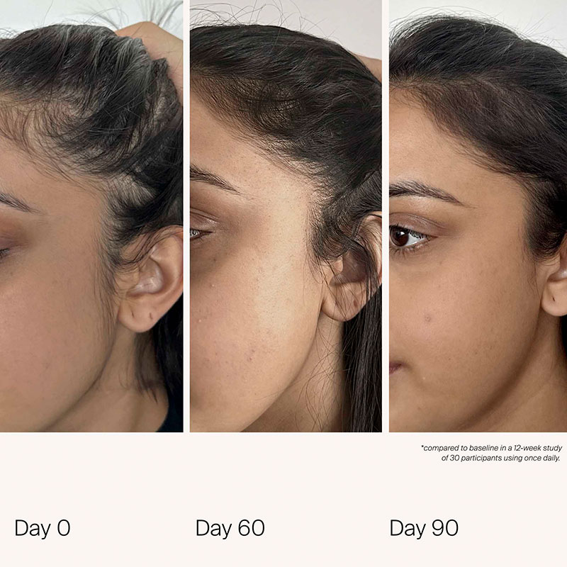 Scalp Care Density Serum - 50ml