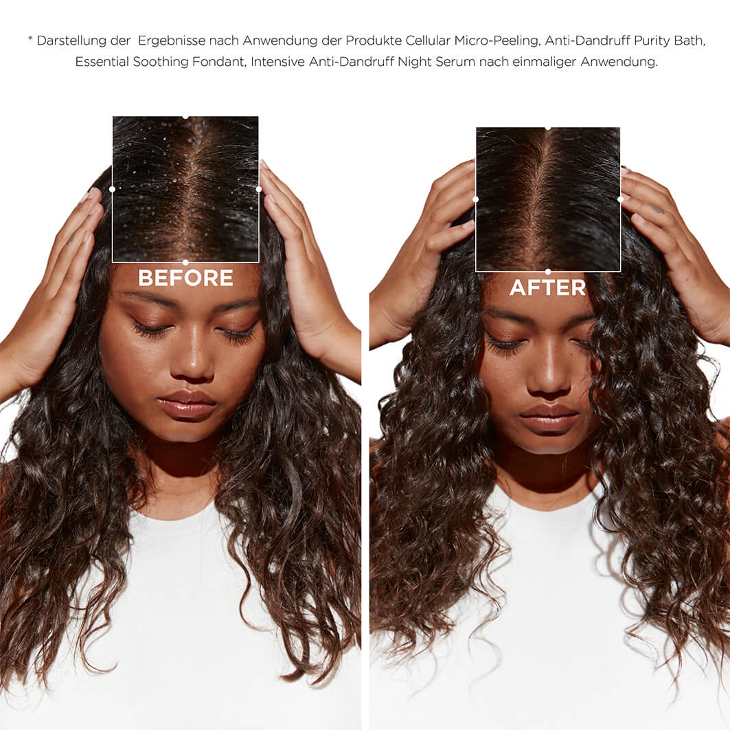 Symbiose Anti-Schuppen Set - 790ml