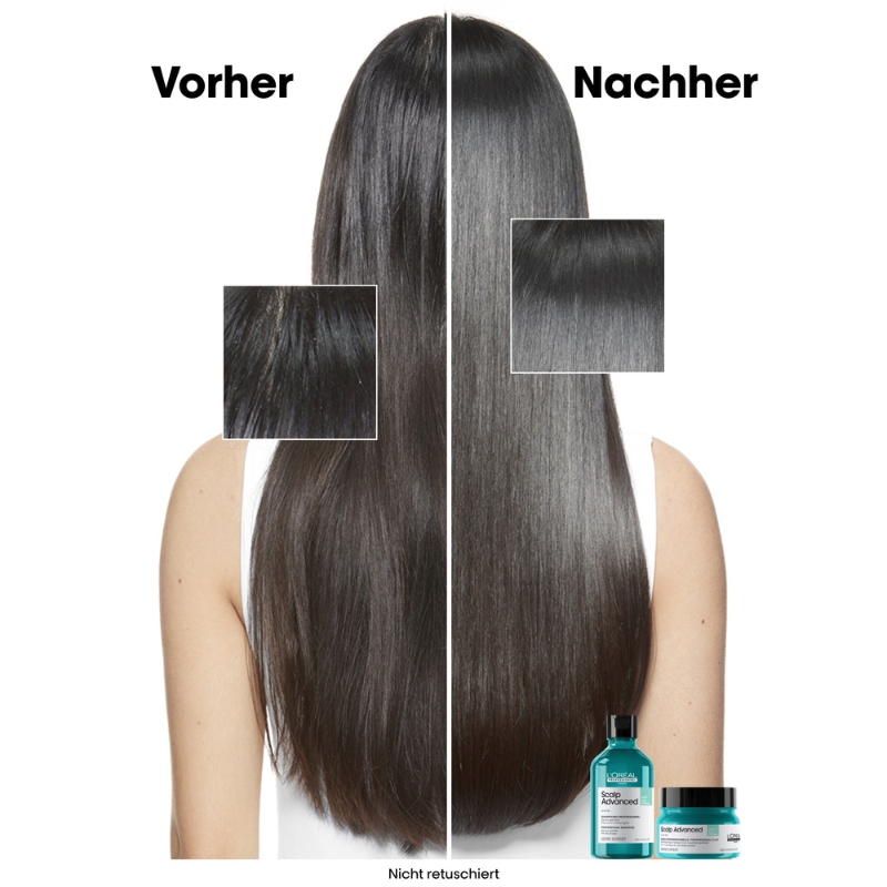 Scalp Advanced Anti-Oiliness Dermo-Purifier Shampoo - 300ml