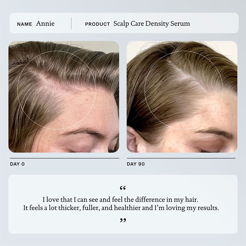 Scalp Care Density Serum - 50ml