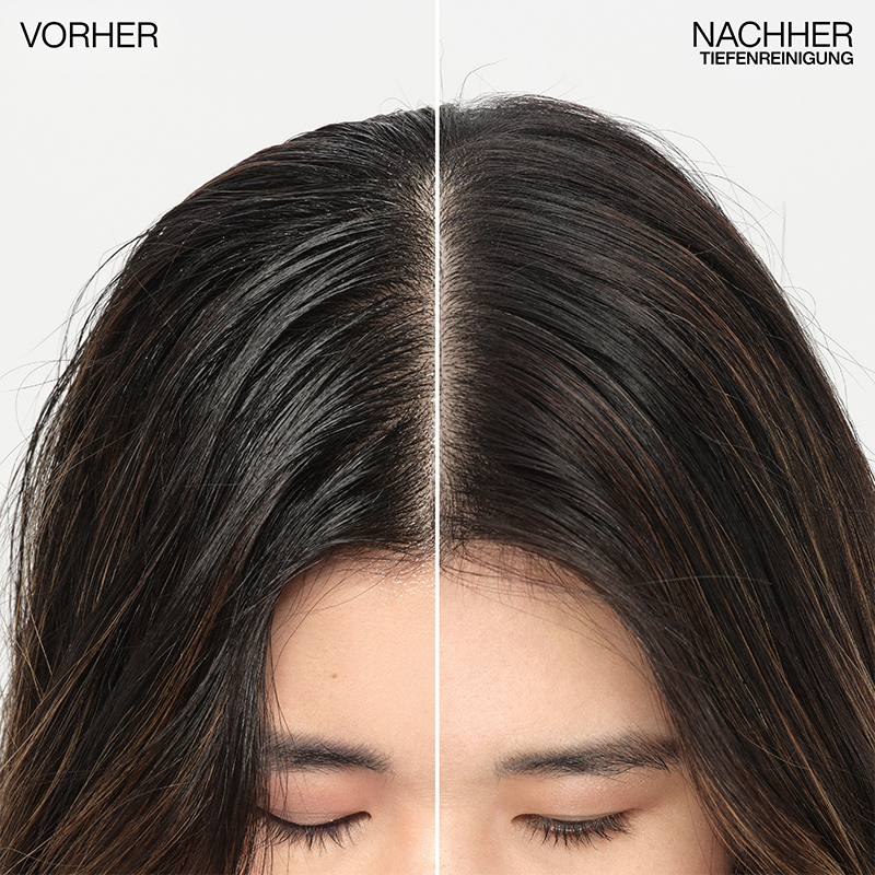 Vorher / Nachher