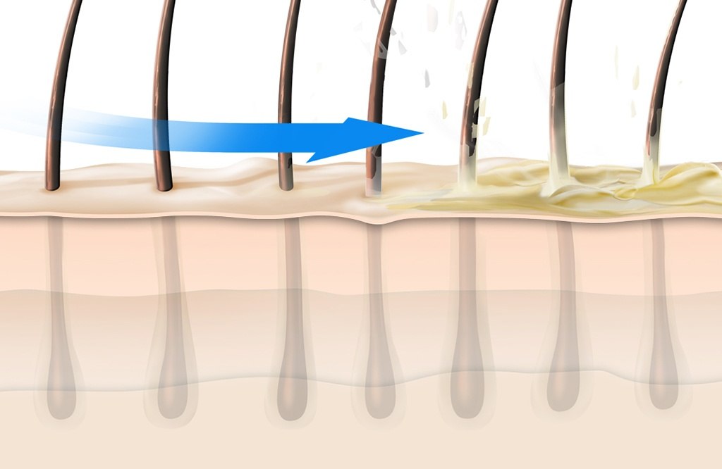 Dualsenses Scalp Specialist Wirkung