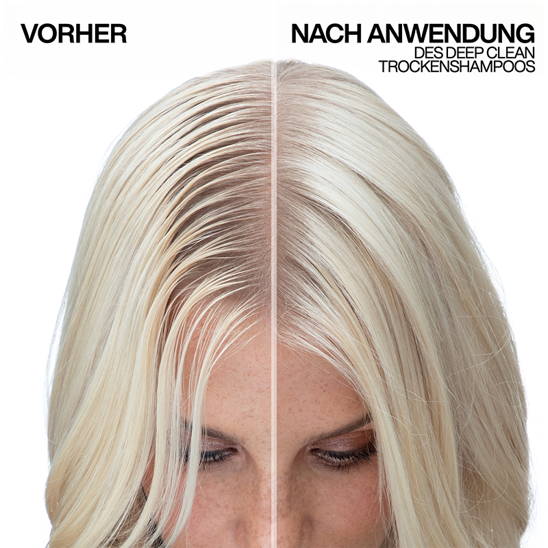 Vorher / Nachher