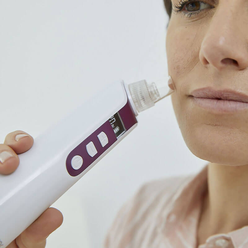 FaceCare - Porenreiniger FC 41